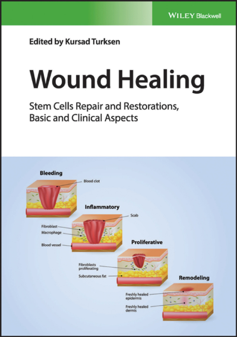 Cover image for book Wound Healing: Stem Cells Repair and Restorations, Basic and Clinical Aspects
