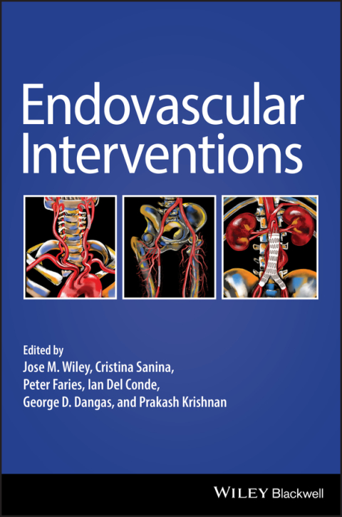 Endovascular Interventions 