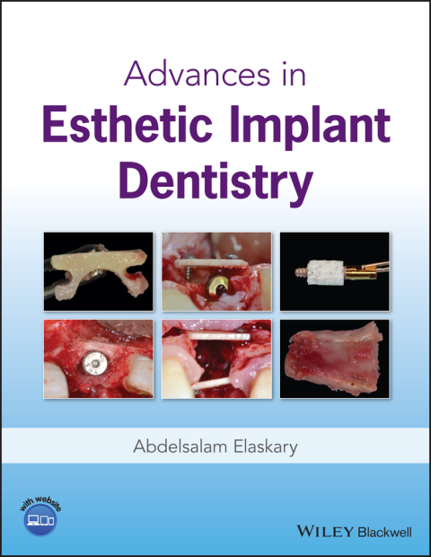 Cover image for book Advances in Esthetic Implant Dentistry