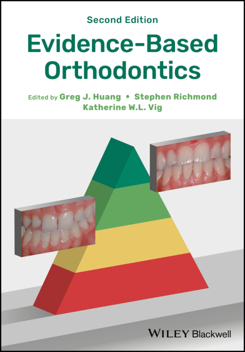 Cover image for book Evidence-Based Orthodontics