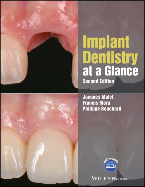 Cover image for book Implant Dentistry at a Glance