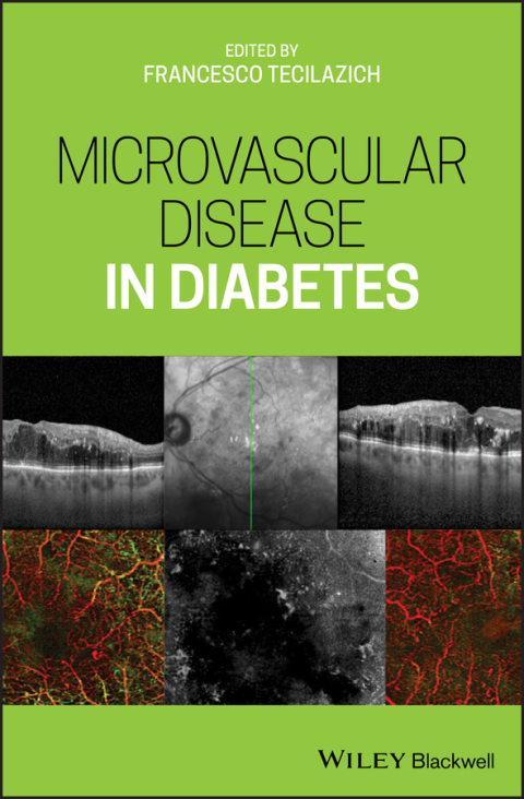Cover image for book Microvascular Disease in Diabetes