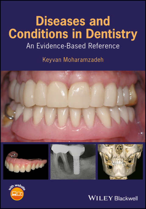 Cover image for book Diseases and Conditions in Dentistry