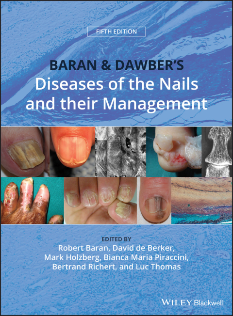 Baran and Dawber's Diseases of the Nails and their Management 