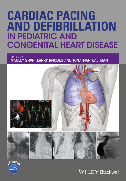 Cover image for book Cardiac Pacing and Defibrillation in Pediatric and Congenital Heart Disease