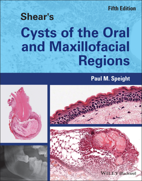 Cover image for book Shear's Cysts of the Oral and Maxillofacial Regions