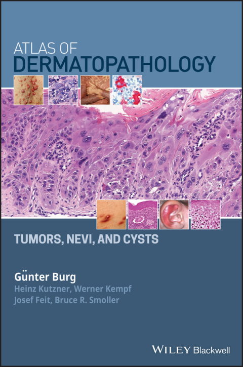Atlas of Dermatopathology: Tumors, Nevi, and Cysts 