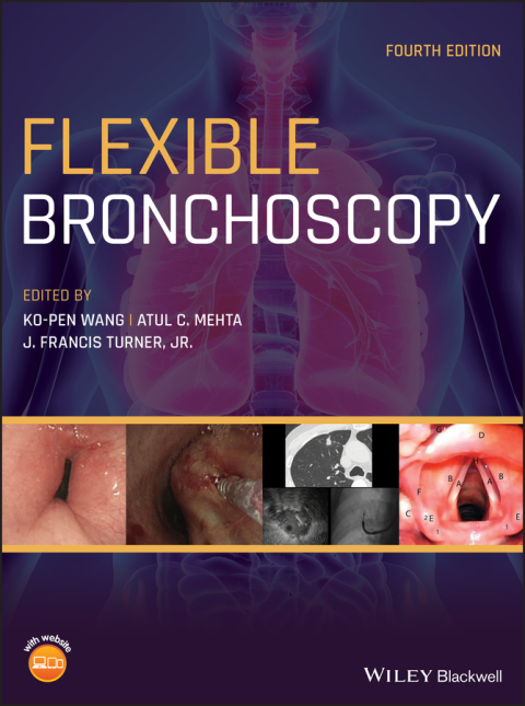 Cover image for book Flexible Bronchoscopy