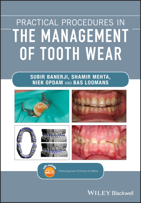 Cover image for book Practical Procedures in the Management of Tooth Wear