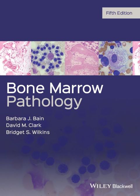 Bone Marrow Pathology 