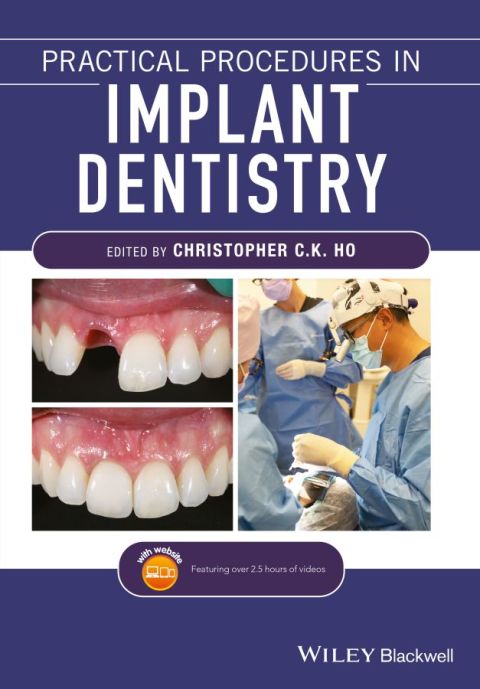 Cover image for book Practical Procedures in Implant Dentistry