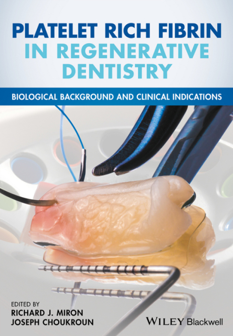 Cover image for book Platelet Rich Fibrin in Regenerative Dentistry: Biological Background and Clinical Indications