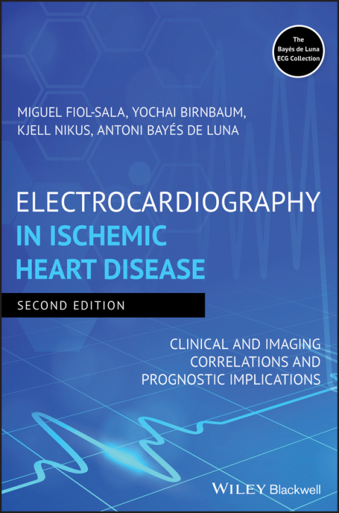 Cover image for book Electrocardiography in Ischemic Heart Disease