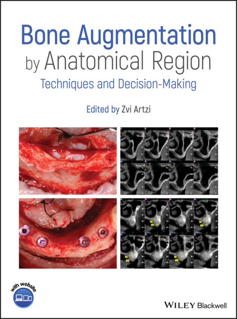 Cover image for book Bone Augmentation by Anatomical Region