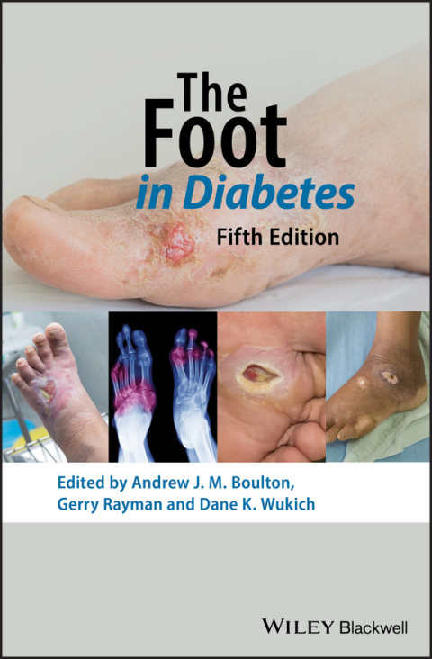 Cover image for book The Foot in Diabetes, 5th Edition