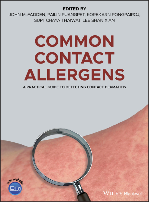 Cover image for book Common Contact Allergens