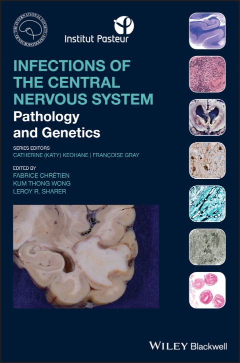 Cover image for book Infections of the Central Nervous System