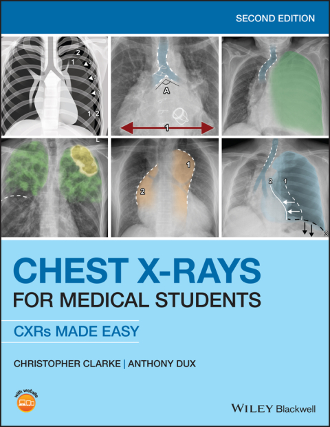 Cover image for book Chest X-Rays for Medical Students