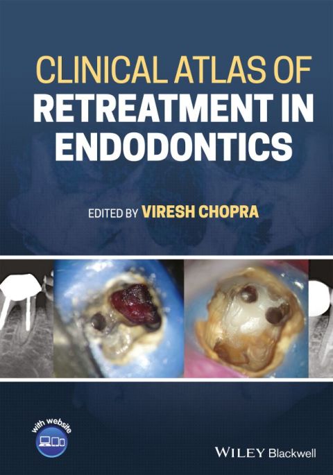 Cover image for book Clinical Atlas of Retreatment in Endodontics