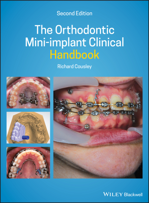 Cover image for book The Orthodontic Mini-implant Clinical Handbook