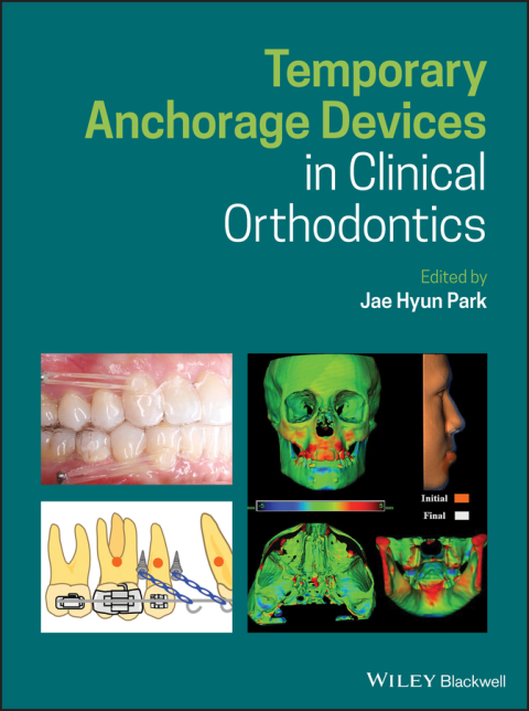 Cover image for book Temporary Anchorage Devices in Clinical Orthodontics