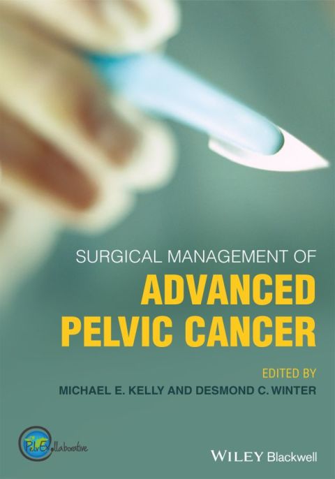 Cover image for book Surgical Management of Advanced Pelvic Cancer
