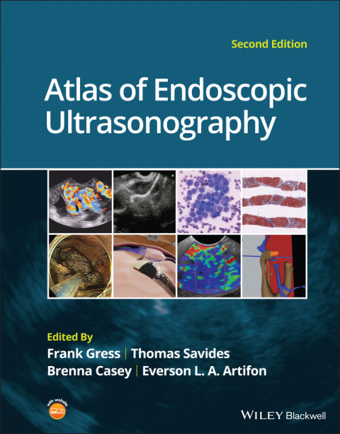 Cover image for book Atlas of Endoscopic Ultrasonography