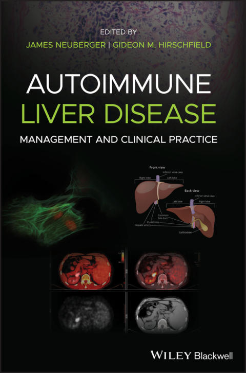 Cover image for book Autoimmune Liver Disease