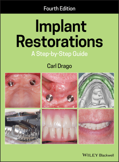 Implant Restorations 