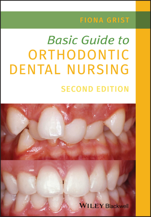 Cover image for book Basic Guide to Orthodontic Dental Nursing