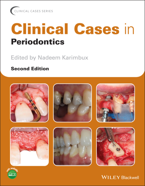 Cover image for book Clinical Cases in Periodontics