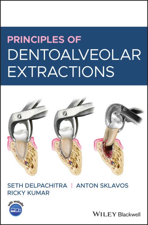 Cover image for book Principles of Dentoalveolar Extractions