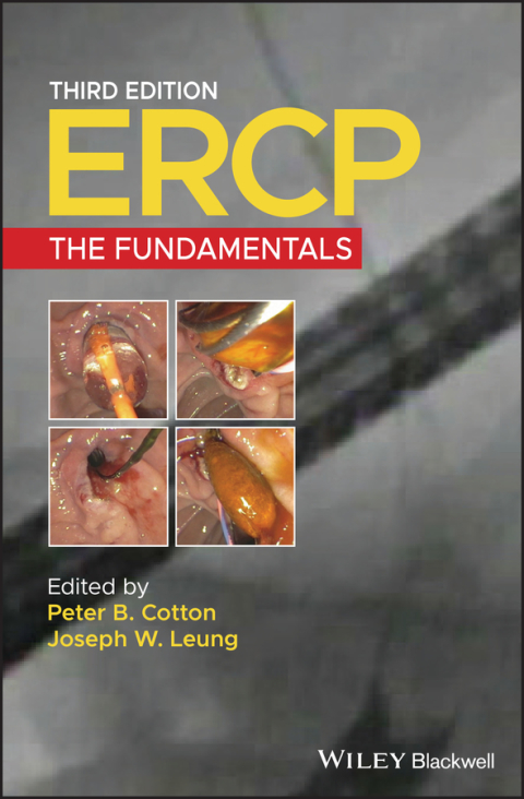 Cover image for book ERCP