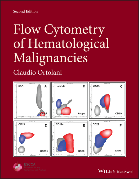 Cover image for book Flow Cytometry of Hematological Malignancies