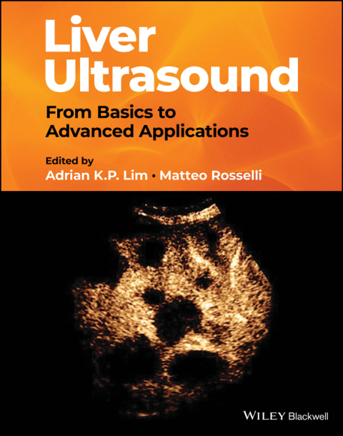 Cover image for book Liver Ultrasound