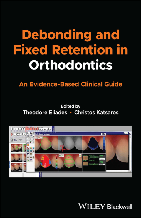 Cover image for book Debonding and Fixed Retention in Orthodontics