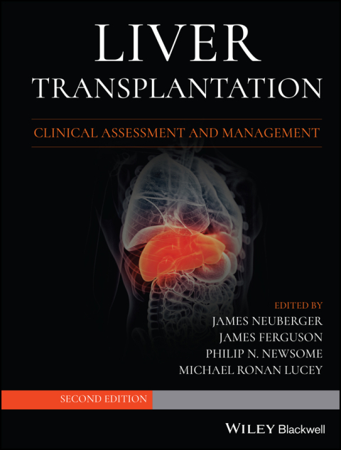 Cover image for book Liver Transplantation: Clinical Assessment and Management, 2nd Edition