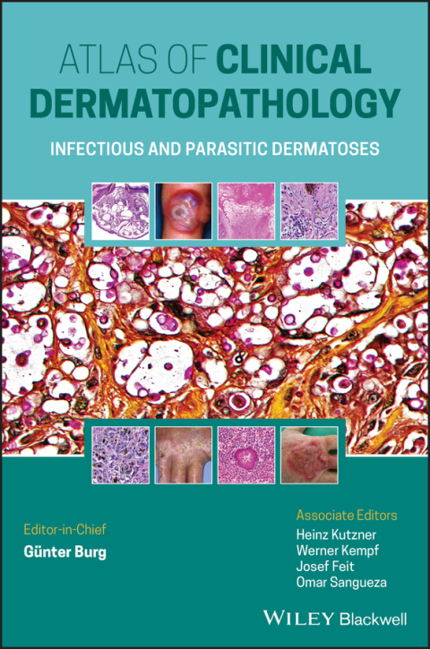 Cover image for book Atlas of Clinical Dermatopathology: Infectious and Parasitic Dermatoses