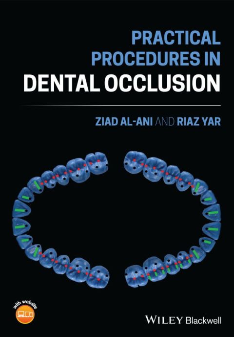 Cover image for book Practical Procedures in Dental Occlusion