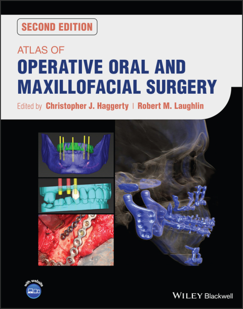 Cover image for book Atlas of Operative Oral and Maxillofacial Surgery