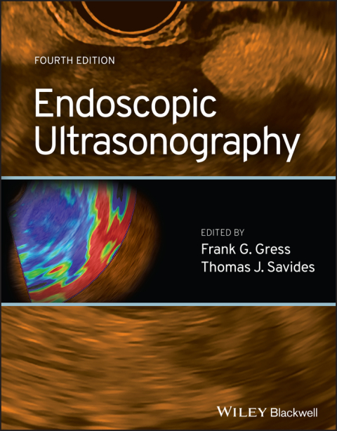 Cover image for book Endoscopic Ultrasonography