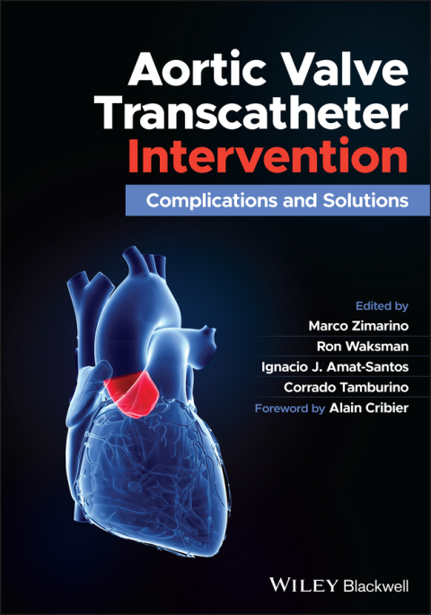 Cover image for book Aortic Valve Transcatheter Intervention