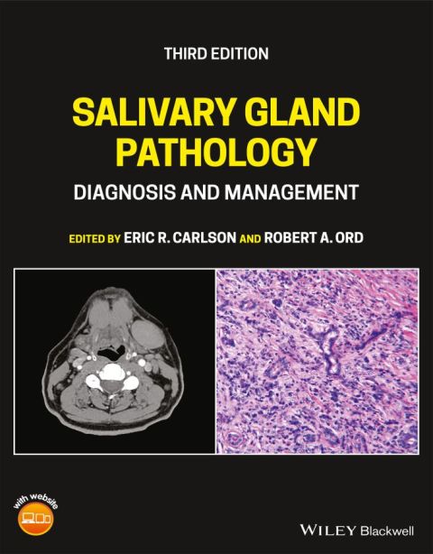 Salivary Gland Pathology: Diagnosis and Management 