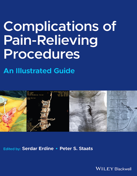 Cover image for book Complications of Pain-Relieving Procedures