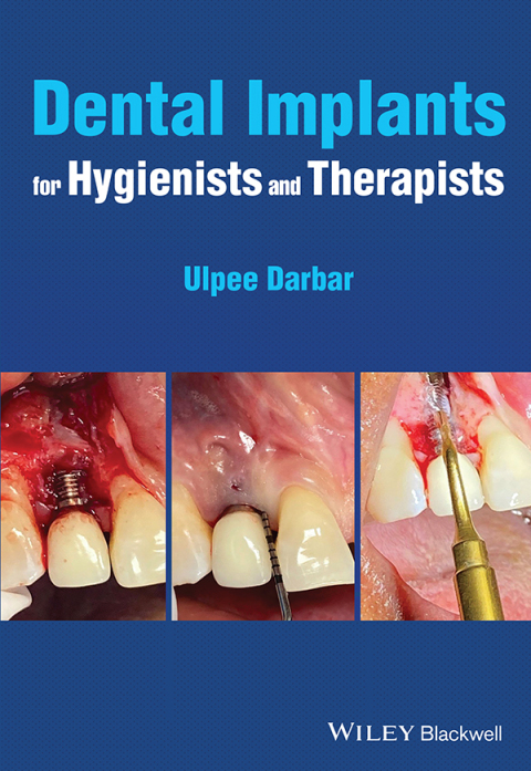 Cover image for book Dental Implants for Hygienists and Therapists
