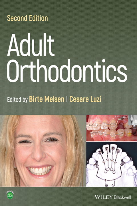 Cover image for book Adult Orthodontics