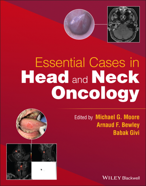 Essential Cases in Head and Neck Oncology 