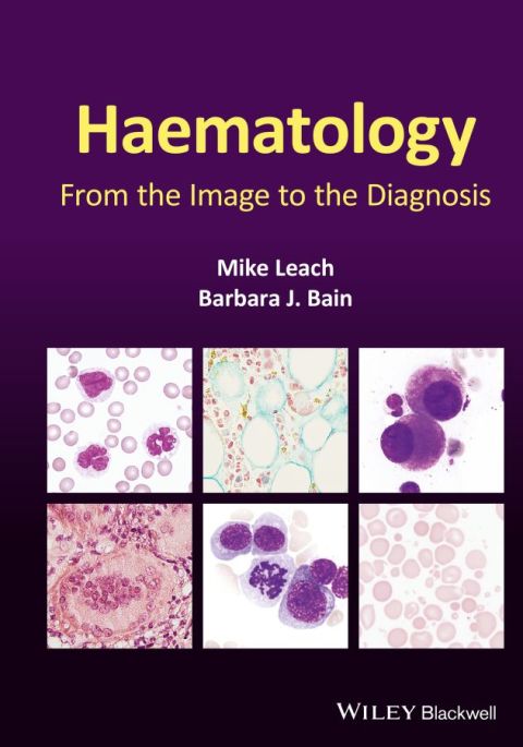 Haematology: From the Image to the Diagnosis 