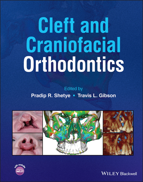 Cover image for book Cleft and Craniofacial Orthodontics