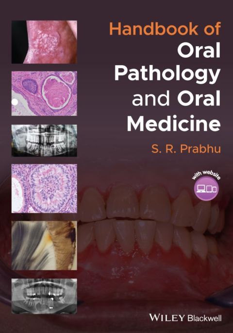 Cover image for book Handbook of Oral Pathology and Oral Medicine